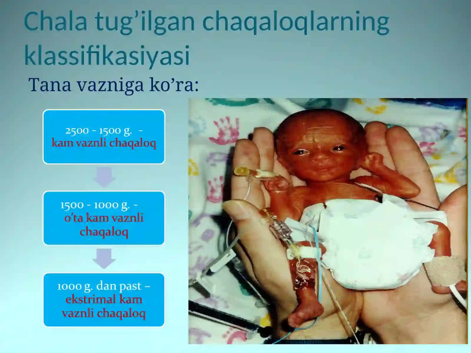 Chala tug’ilgan chaqaloqlar 4