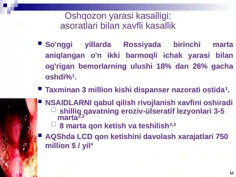 Oshqozon yarasi va BPK epidemiologiyasi 4