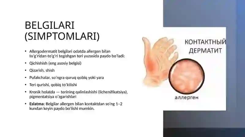 Allergodermatitlar 4