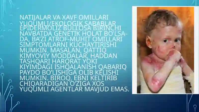 Bullyoz epidermoliz. Xeyli-Xeyli kasalligi. Chuqur mikozlar 4