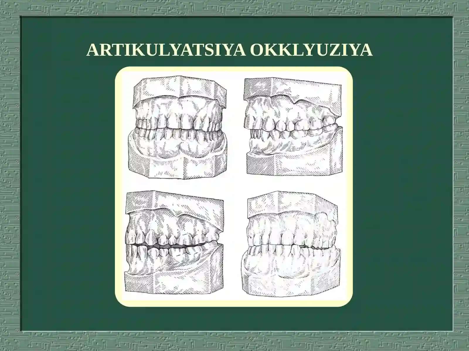 ORTOPEDIK STOMATOLOGIYA BULIMIDA 4