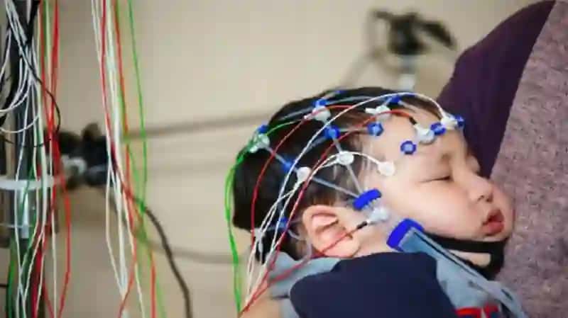 Elektrografiya Usullarini fizik asoslari (eeg, emg) 4