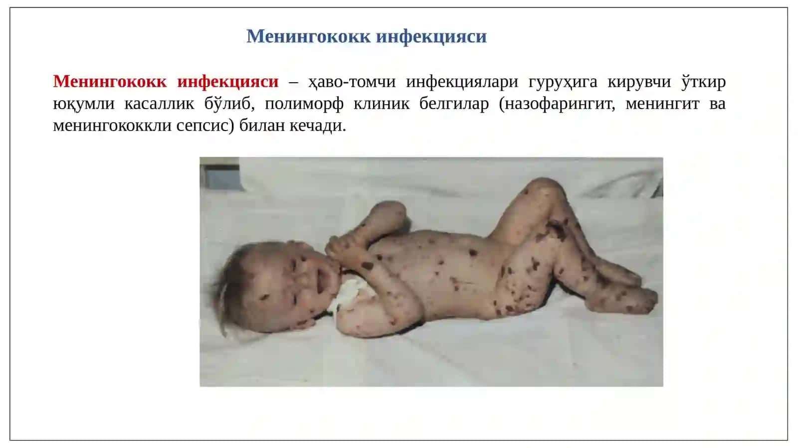 “Ҳаво-томчи йўли билан юқадиган касалликлар, тошмасиз кечадиган касалликларни олдини олиш ва ҳамшира парвариши” 4