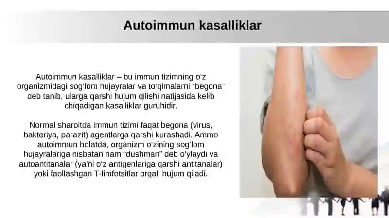 Immunologik tolerantlik nuqsonlari. Autoimmun xastaliklar. Psevdoallergiya. Atopikkasalliklar haqida tushuncha, dori va ozuqaviy allergiya 4