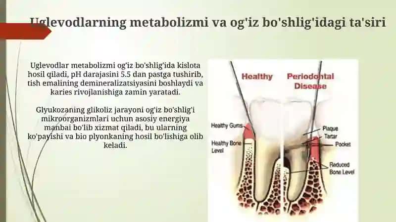 Tish qattiq to'qimasi kasalliklarini kelib chiqishida uglevodlarning ro'li 4