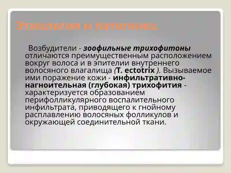 Микоз волосистой части головы 4