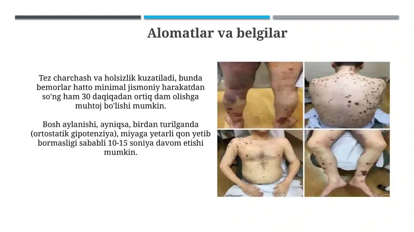 O'tkir qon tanqisligi 4