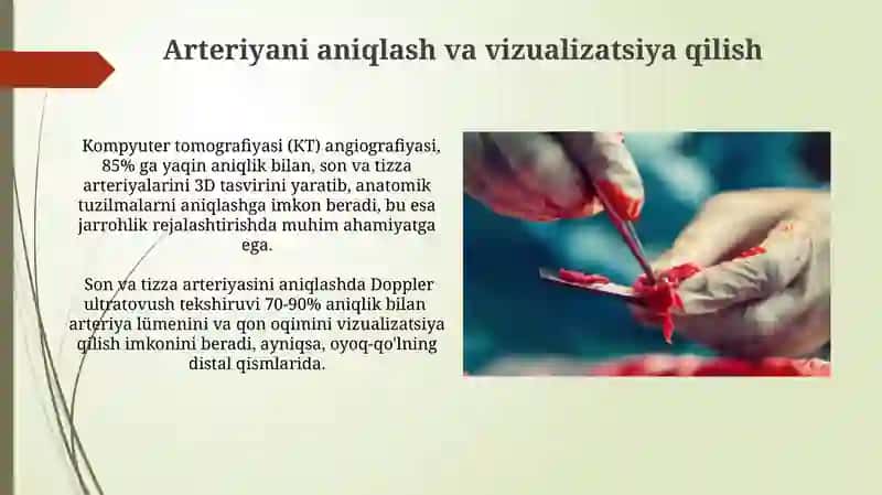 Son Va Tizza Arteriyasini Ochish Jarayoni 4