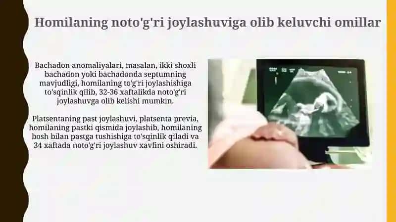 Homilaning noto'g'ri joylashuvi: Diagnostika va Asosiy Turlari 4