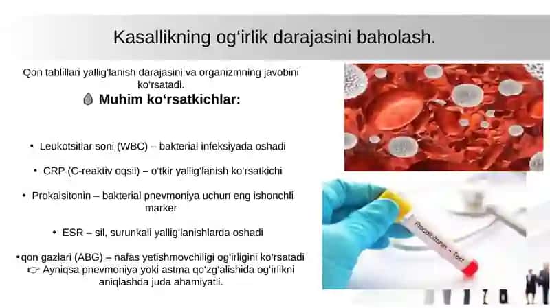 Nafas  a’zolari  kasalliklaridagi  balg‘am  va  plevra  suyuqligini  labarator tekshiruv natijalarini interpretatsiyasi 4