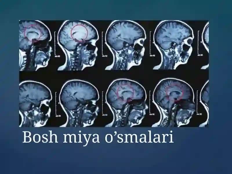 Kanserogen agentlar va ularning hujayralar bilan o‘zaro tasiri. O‘sma immuniteti. 4