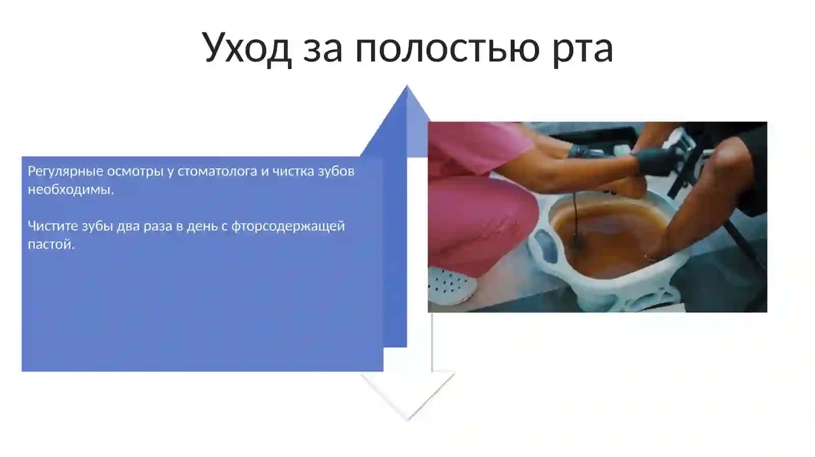 Кариес зубов 4