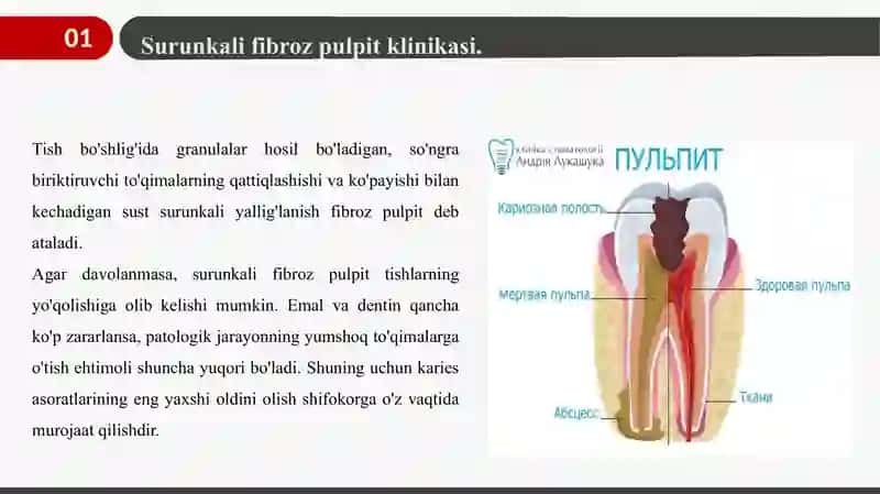 Surunkali Fibroz Pulpit - Сурункали Фиброз Пульпит 4