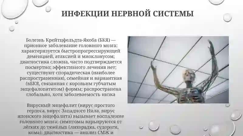 Заболевания нервной системы 4