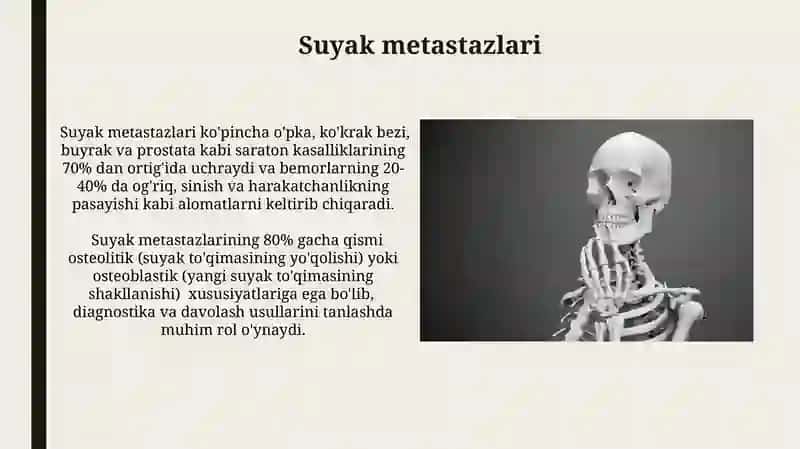 Suyak va bo'g'imlarning degenerativ kasalliklari 4