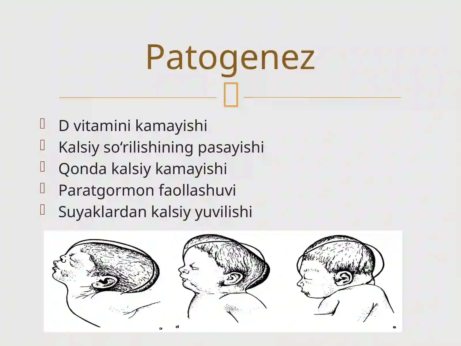 Raxit kasalligi 4