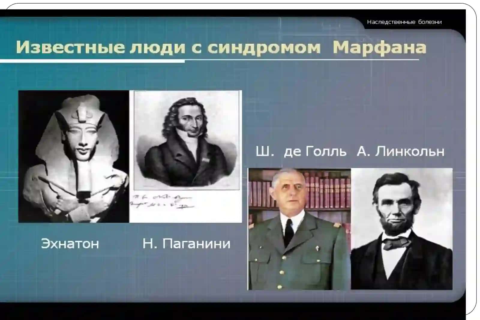 Наследственные болезни с нарушением соединительной ткани и скелета 4