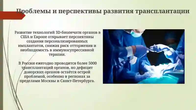 Развитие трансплантации хирургии на современном этапе 4