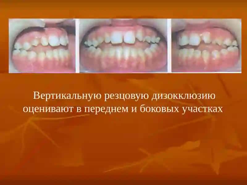 ОТКРЫТЫЙ ПРИКУС 4