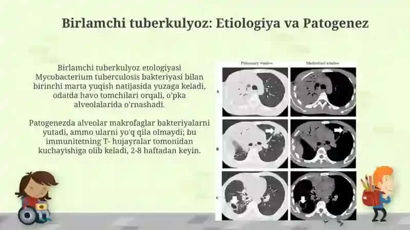 Tuberkulyozning klinik tasnifi 4