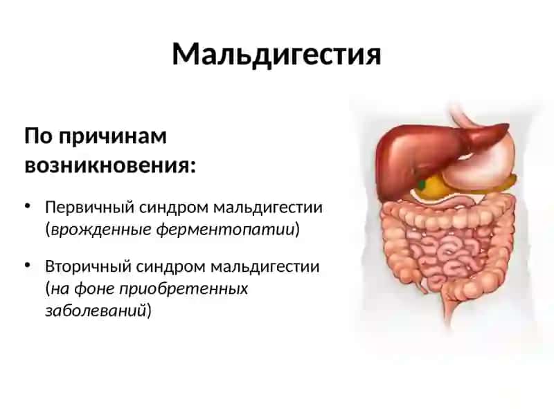 ОСНОВНЫЕ СИНДРОМЫ ПРИ  ЗАБОЛЕВАНИЯХ КИШЕЧНИКА 4
