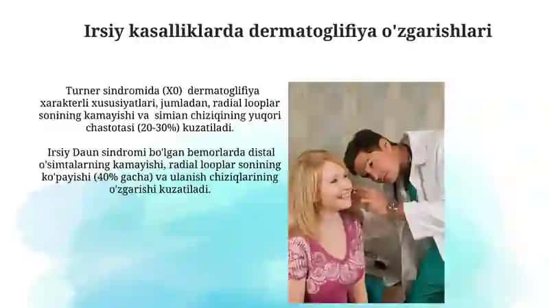 Dermatoglifika. Daktiloskopiya. Turli irsiy kasalliklarda dermatoglifik 4