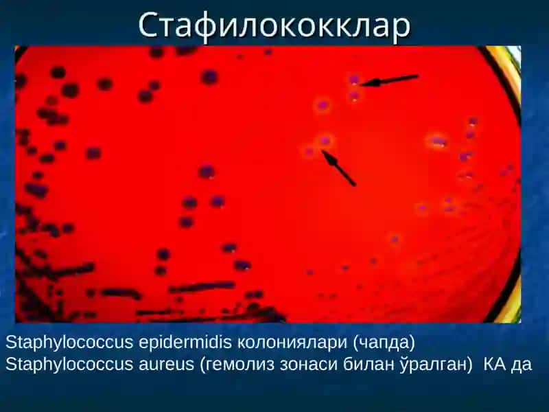 Йирингли яллиғланиш жараёнларини келтириб чиқарувчи микроорганизимлар 4
