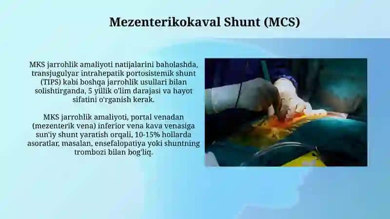 Portal Vena Shuntlash Operatsiyalari 4