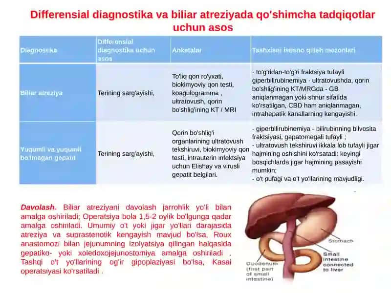 Xoletsistopatiya 4