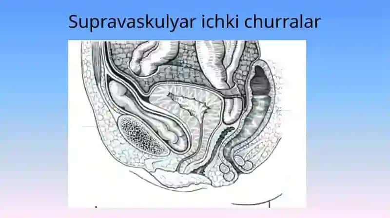 Ichki churralar 4