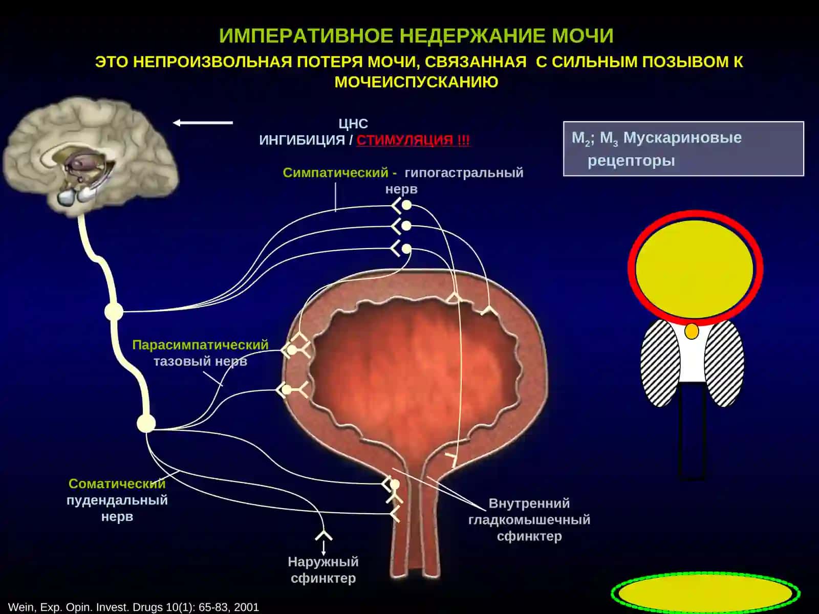 НЕДЕРЖАНИЕ МОЧИ У ЖЕНЩИН 4