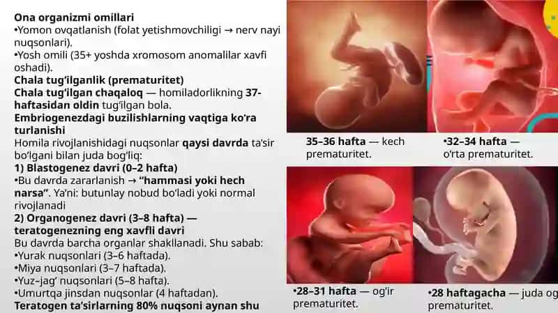 Tug’ma anomaliyalar.Chala tug’ilganlardagi buzilishlar 4