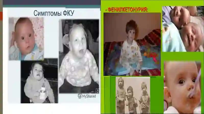 Irsiy kasaliklari mavjud bemorlarda moddalar almashinuvi xususiyatlari 4