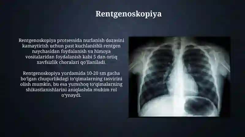 Rentgen nurlanishi, Rentgen nurlarining tibbiyotdagi ahamiyati 4