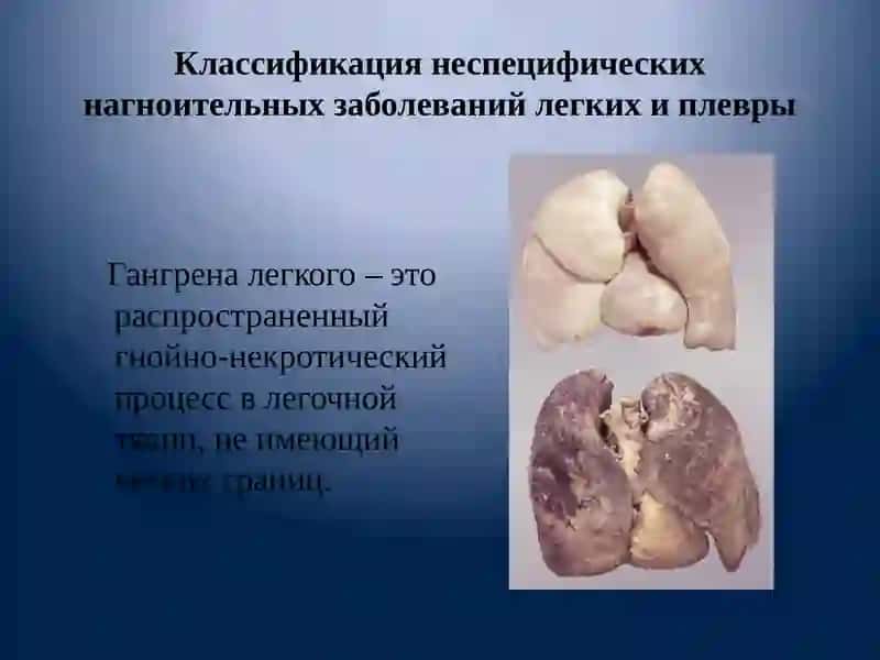 Гнойные заболевания легких и плевры 4