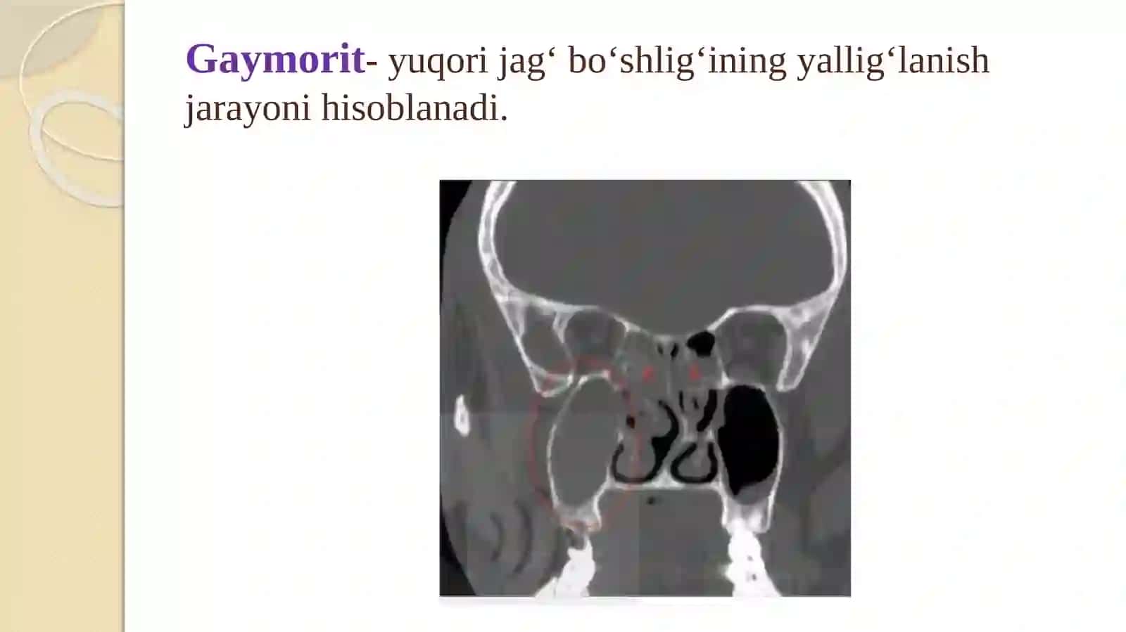 Gaymorit 4