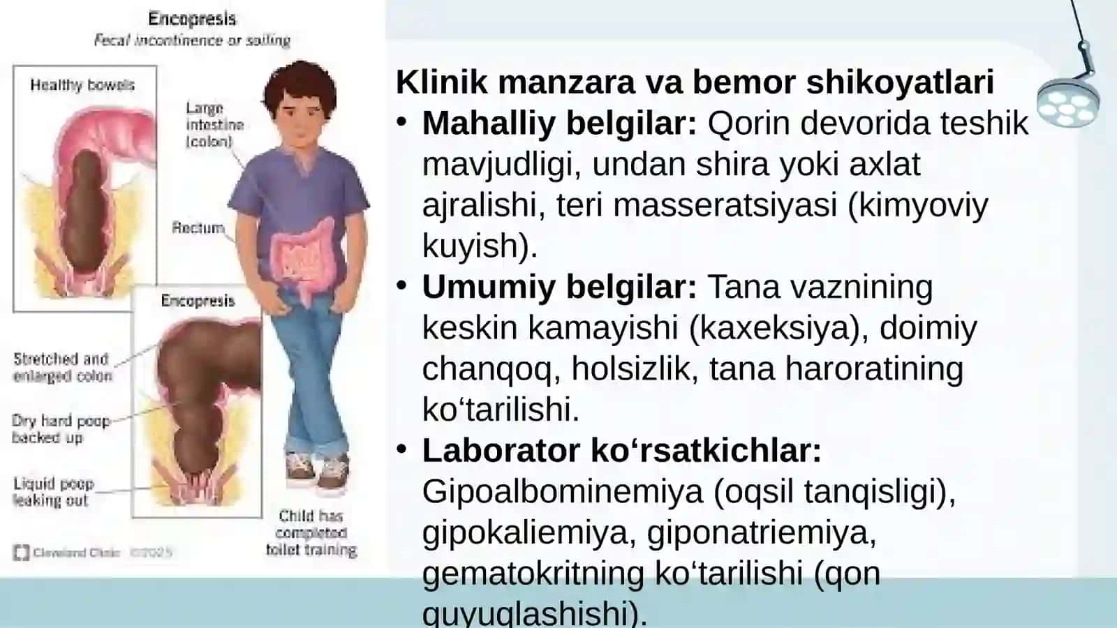 ICHAK OQMA YARALARNI BARTARAF QILISH USULLARI 4