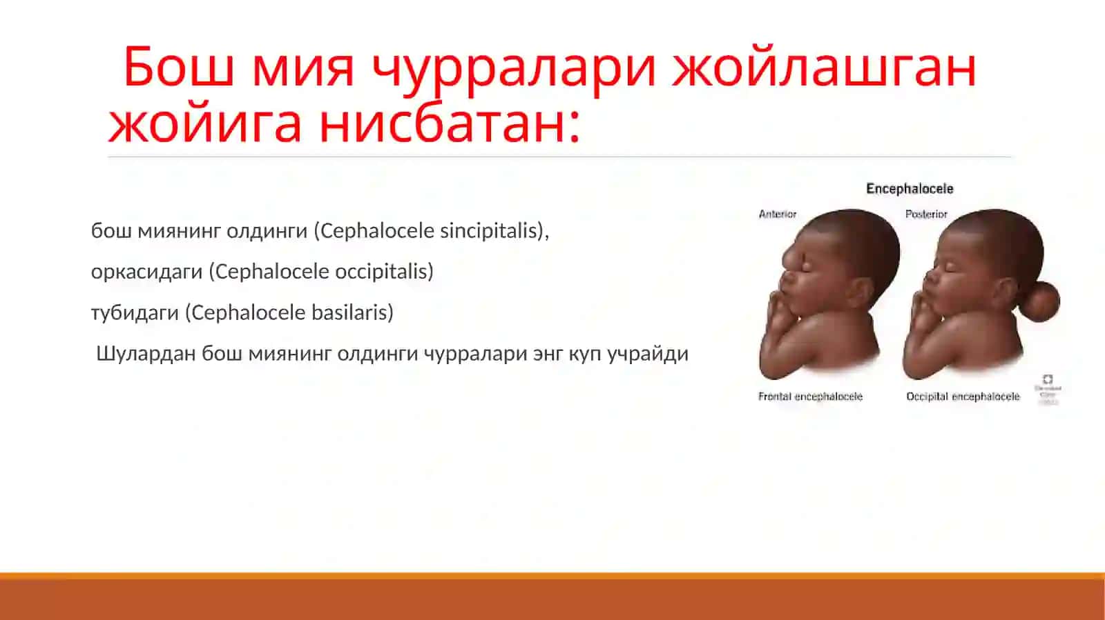 BOSH MIYA VA ORQA MIYANING TUG’MA RIVOJLANISH NUQSONLARI 4