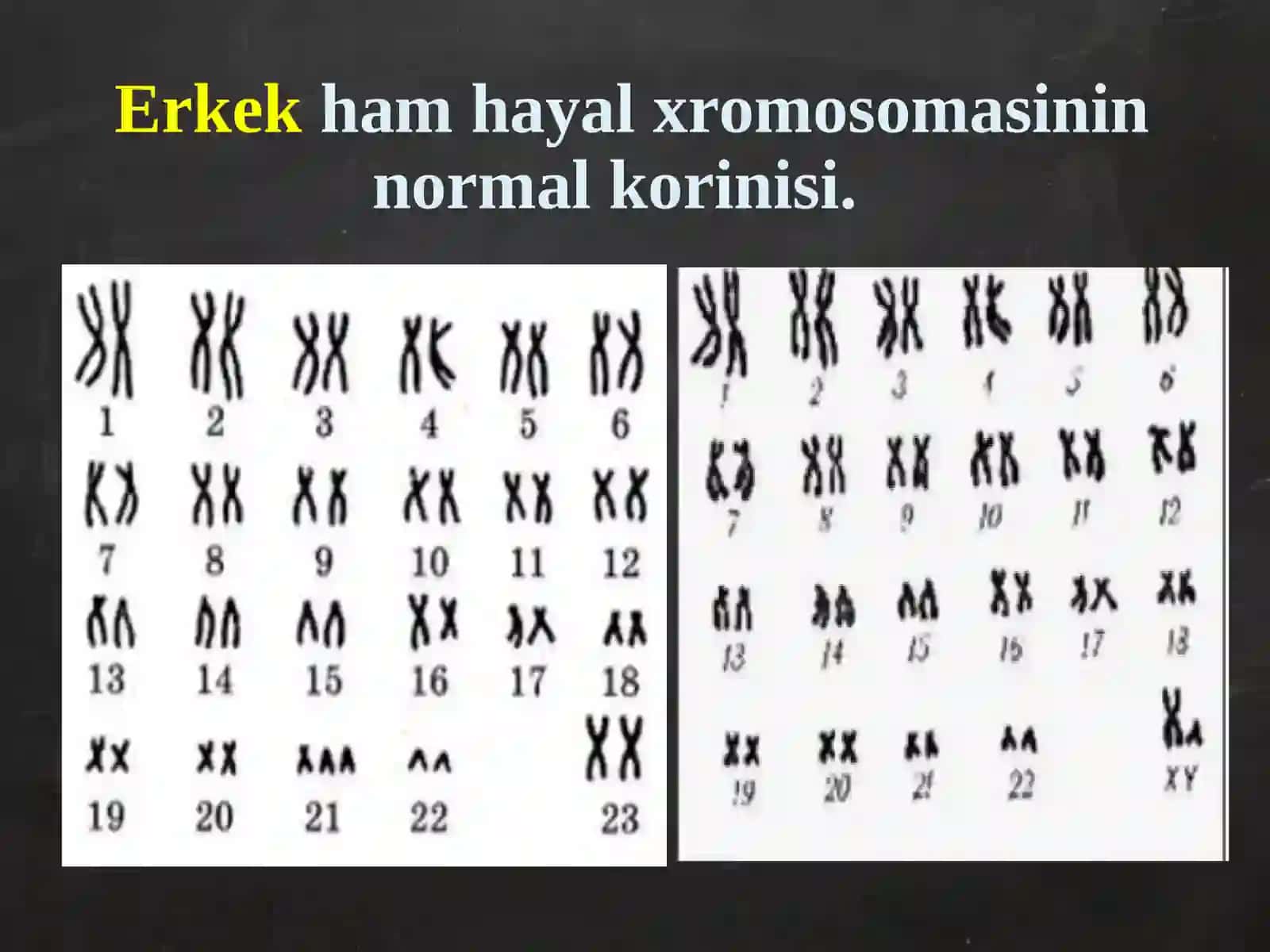 Adamda ushraytugin nasillik keselliklerdi uyreniw ham analizlew 4