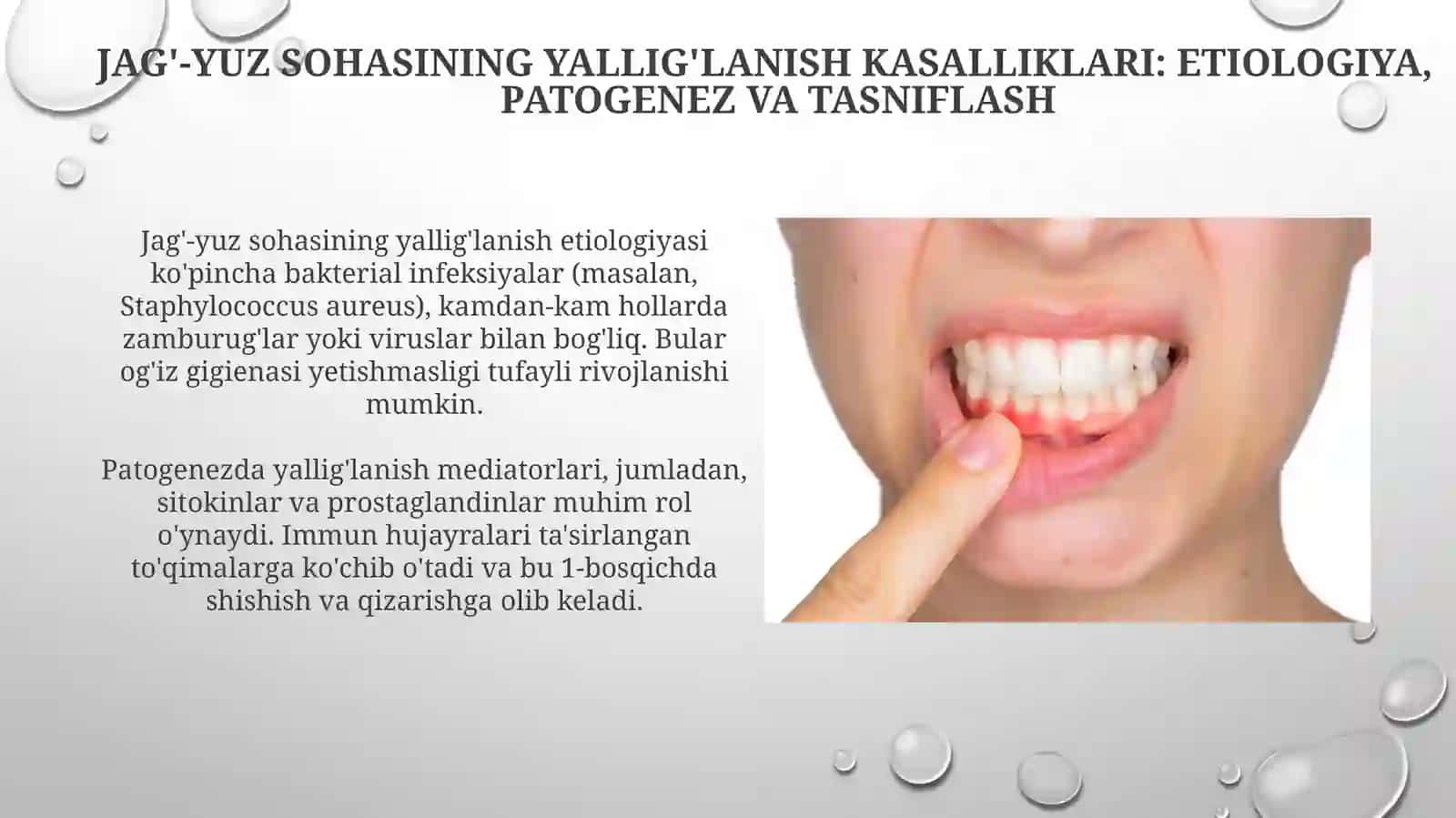 Og'iz shilliq qavati va yuz jag’ yallig’lanishi kasalliklari 4