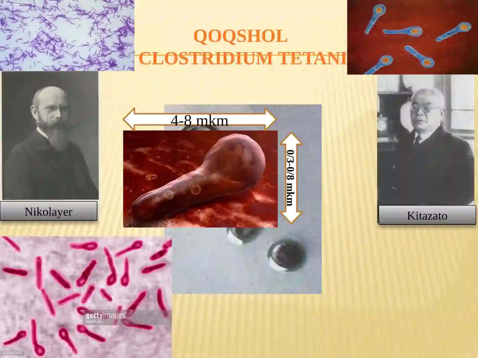 Patogen anaeroblar.Qoqshol,gazli gangrena qoʼzgʼatuvchilari va ularning biologik xususiyatlari 4