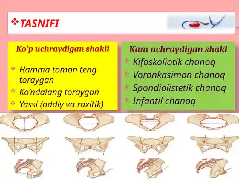 Chanoqanomaliyalar 4
