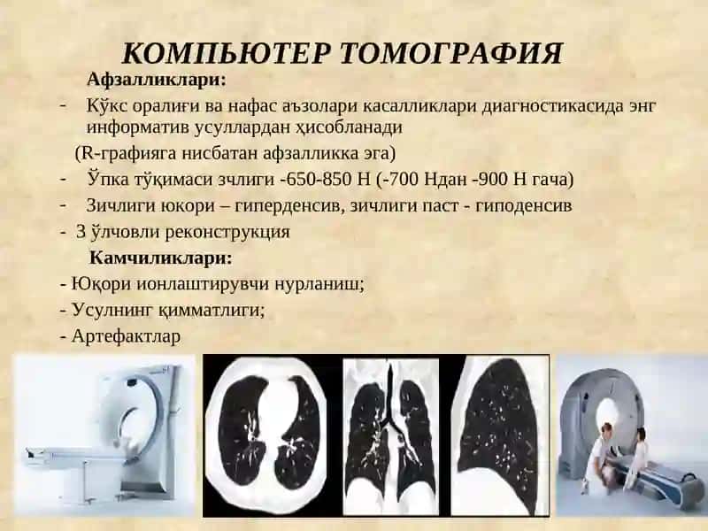 Нафас аъзолари касалликларининг комплекс нур диагностикаси 4