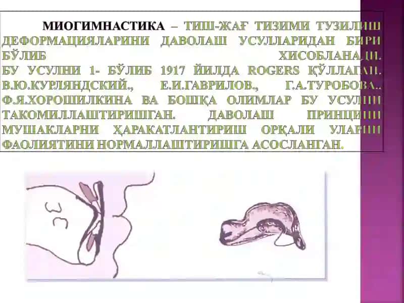 Ортодонтик даволашнинг асосий тамоиллари 4
