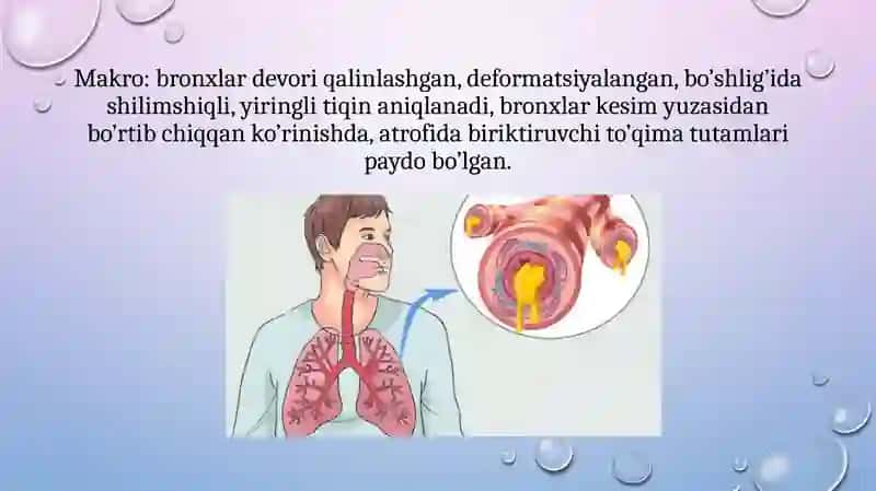 Surunkalibronxitetiologiyasi, patogenezi, patologikanatomiyasi, asoratlari 4
