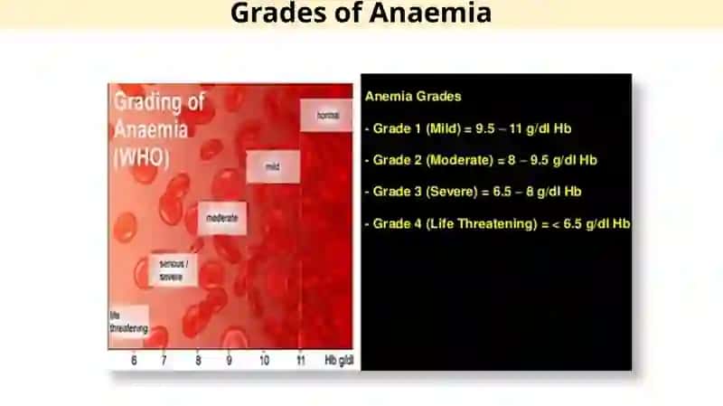 Anemia 4