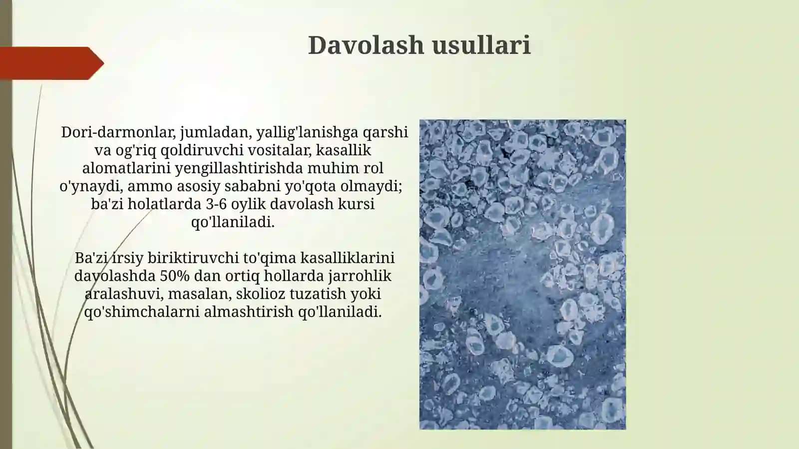Tish qattiq to'qimasining nasliy kasalliklari 4