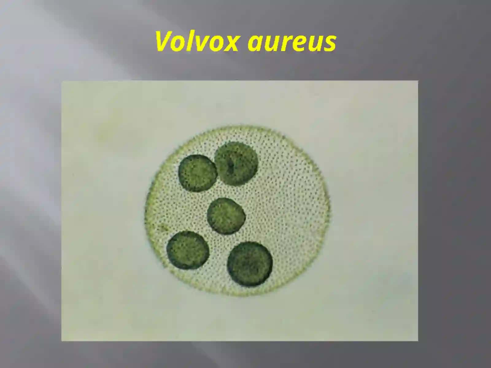 Protozoa кенжа дунёси (Бир ҳужайралилар) 4