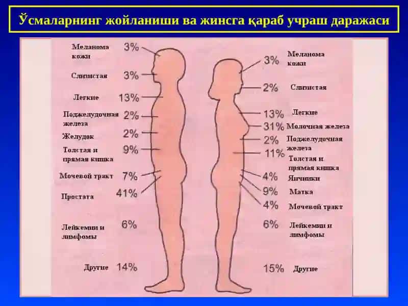Ўсмалар, умумий тушинчалар. Эпителий ўсмалари 4