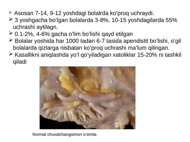 3 yoshgacha bo’lgan bolalarda O`tkir appenditsit 4